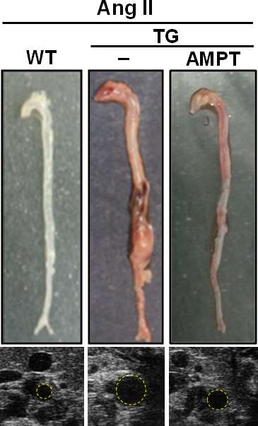 Tyrosine hydroxylase inhibitors for treatment of aortic aneurysm