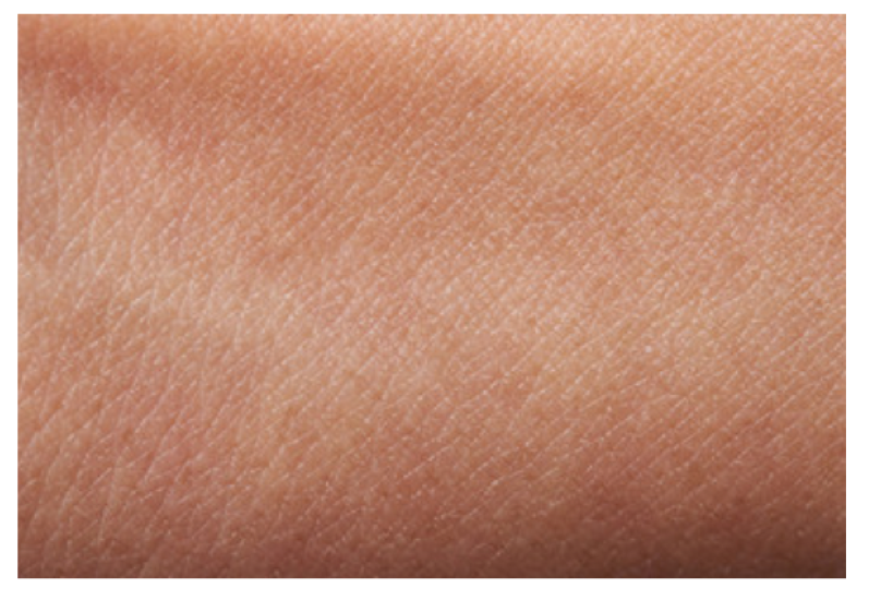 Seeking a new active ingredient technology for a topical cosmetic application for diabetic skin
