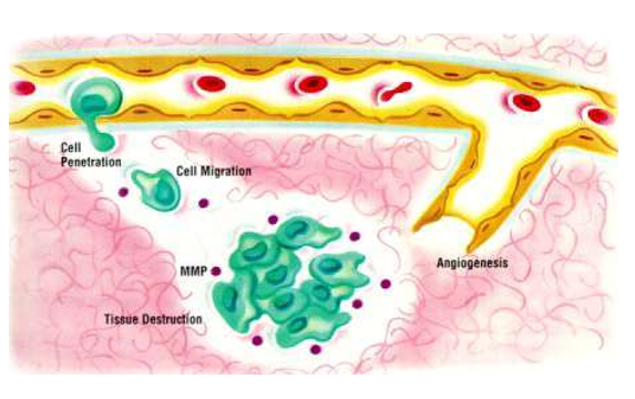 Antibody Based Therapy to Treat Cancer and GI Related Diseases