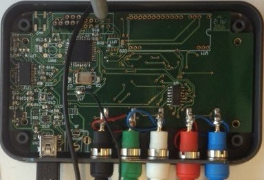 Biofeedback system for urinary incontinence treatment
