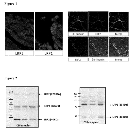 In vitro method for the diagnosis or prognosis of neurodegenerative disorders