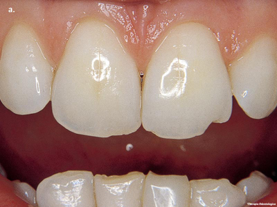 Seeking Dental  Clinical Databases – Ebmg