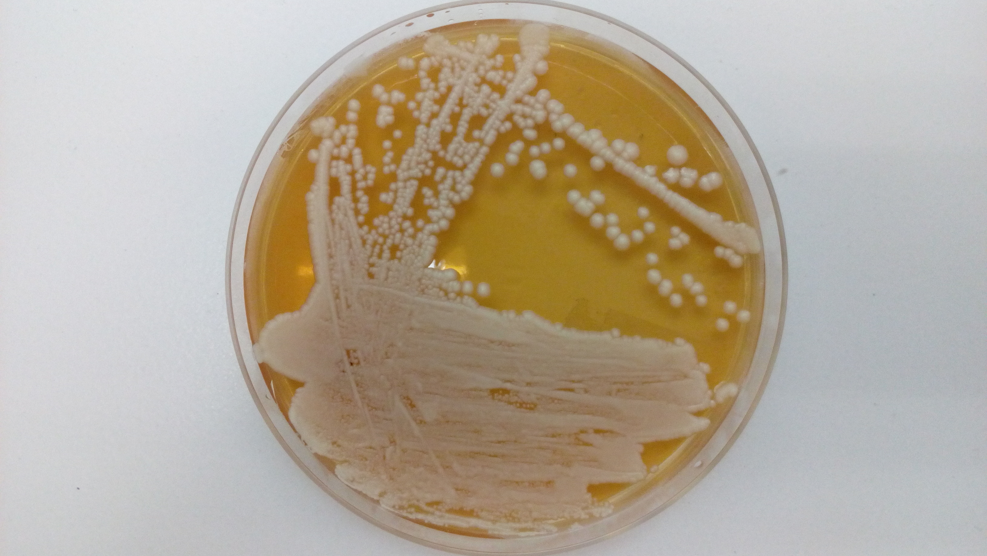 Seeking a method for controlling the implantation of yeasts during alcoholic fermentation