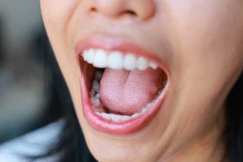 Seeking Solutions for Repair and Protection of Enamel and Dentin