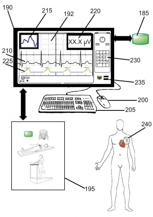 Device and method for ventricular repolarization alternans detection by windowing.