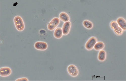 Chromatium Cultivation-Microbialtec Research