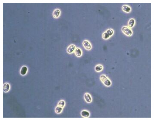Thiocystis Cultivation-Microbialtec Research