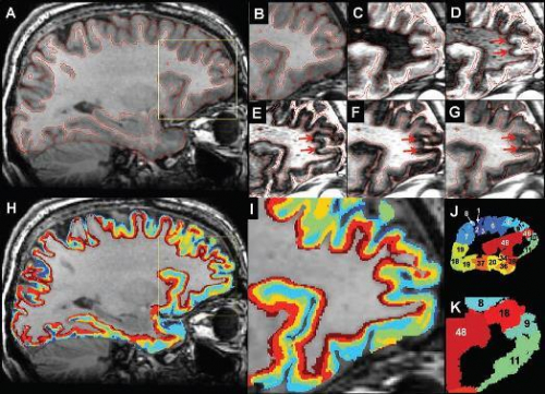 Whole Brain Visualization of Distinct Cortical Layers by MRI