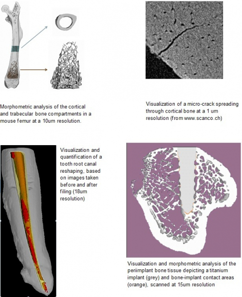 analysis of mineralized tissues using microCT
